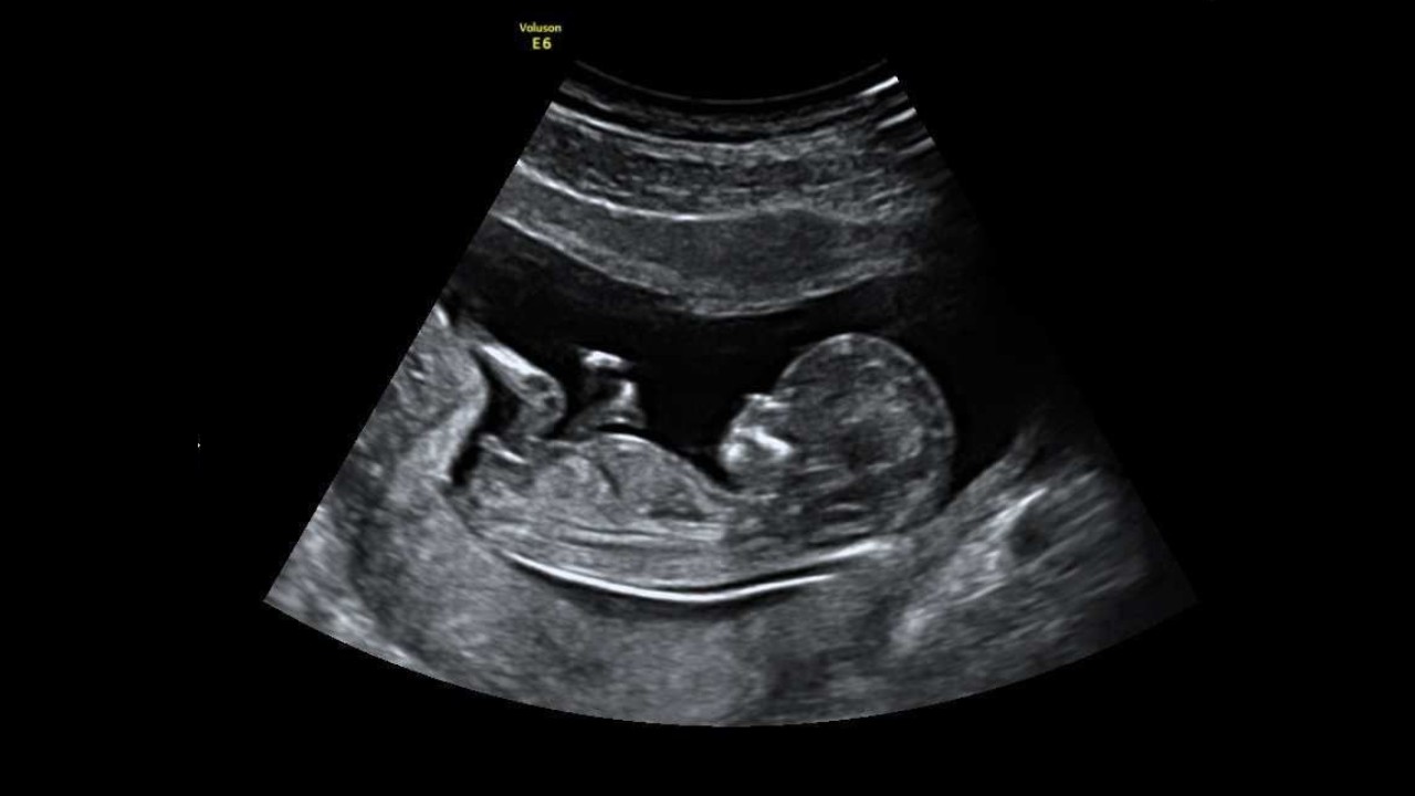 حقوق الجنين في الإسلام