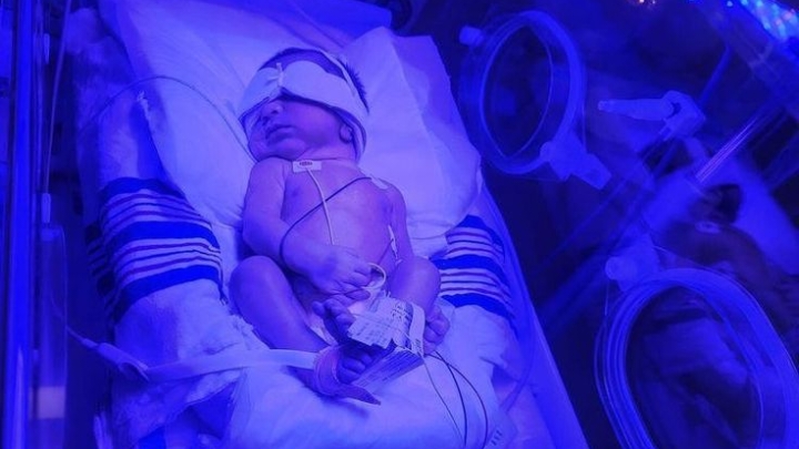 اليرقان الوليدي Neonatal jaundice